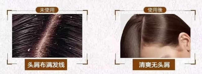 脱发、掉发、头发稀少？用它洗洗，一次就离不开